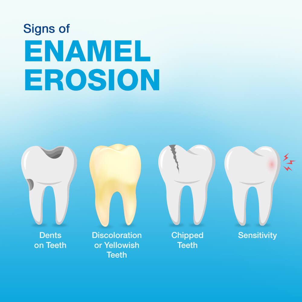 What Is The Enamel Of The Teeth