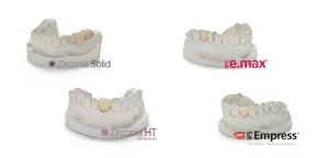 What are the 3 types of crowns?