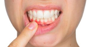 Can you fix gum disease?