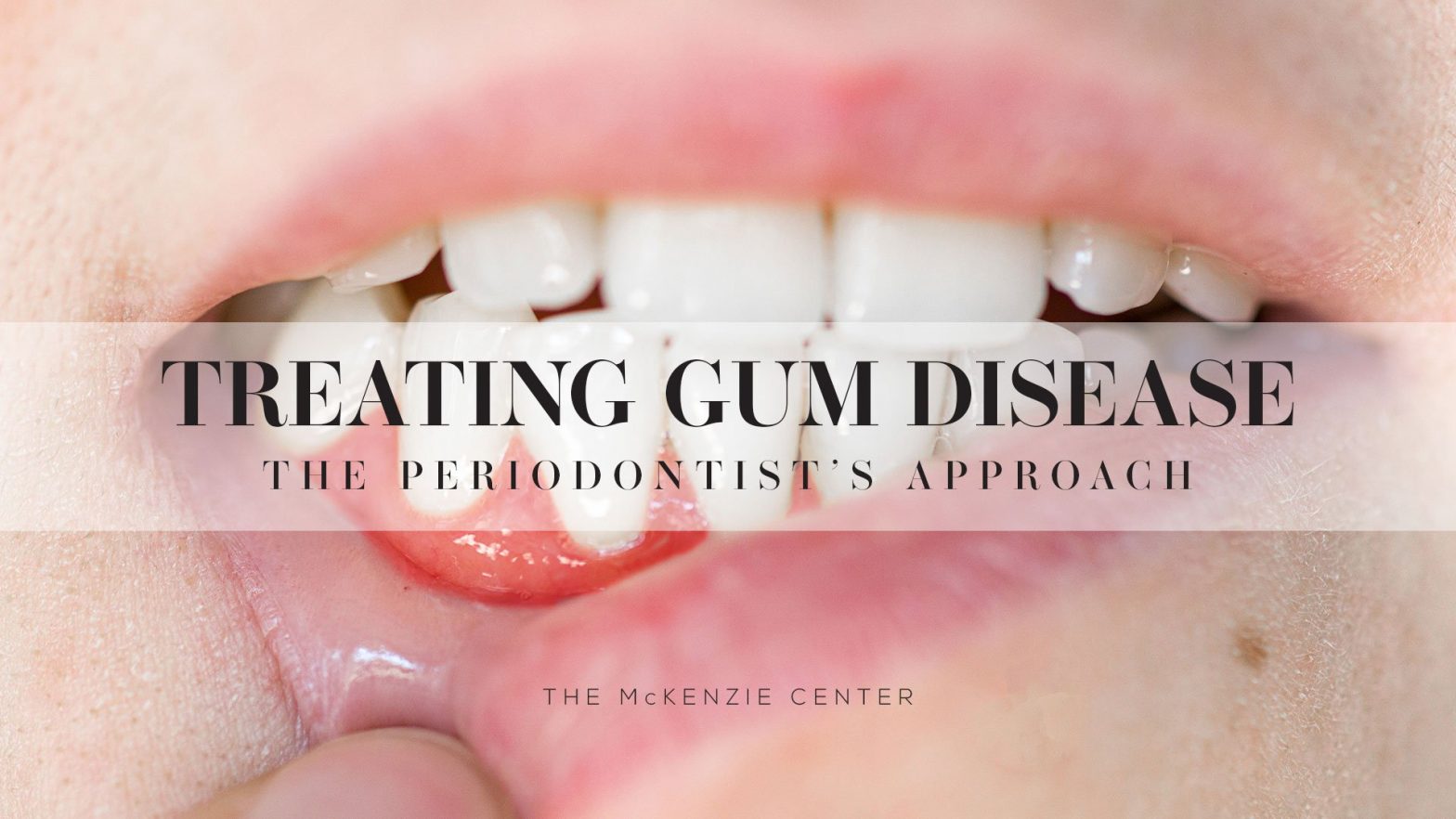How do you fix gum disease on your teeth?