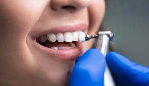 How much is the cost for teeth cleaning?