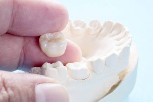 disadvantages of dental crowns