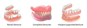 dentures cost for teeth