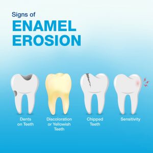 enamel of the teeth