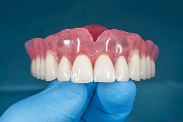 What are the four types of dentures?