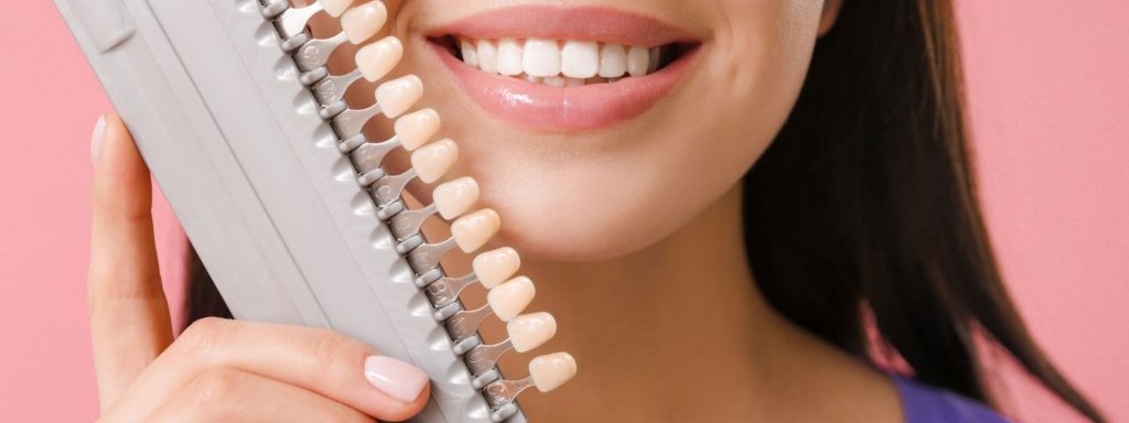 Can veneers be covered by Medicare?