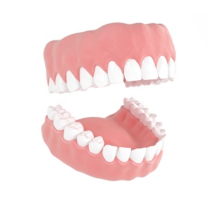 How much do dentures cost for teeth?