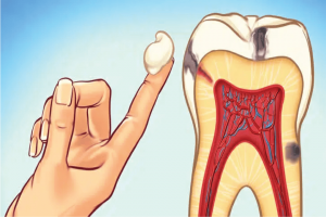 tooth nerve pain serious