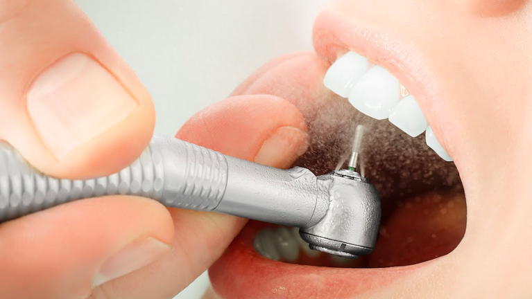 Are tooth fillings painful?