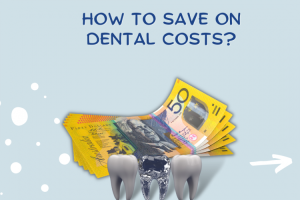 Dental Costs in NSW: How to Save on Your Next Appointment