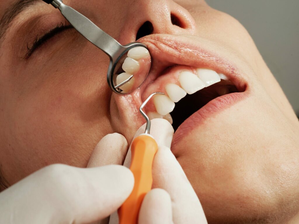 The Importance of Regular Dental Cleanings and Checkups