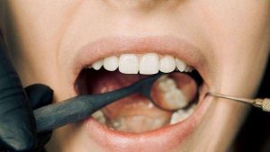 The Most Common Dental Problems in NSW – And How to Prevent Them