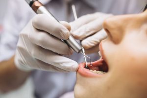 Everything You Need to Know About Tooth Crowns: A Complete Guide Everything You Need to Know About Tooth Crowns: A Complete Guide