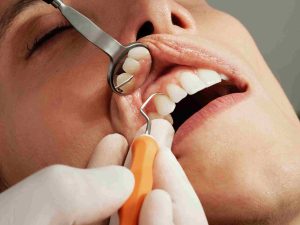 How to Prepare for a Dentist Appointment: Complete Guide