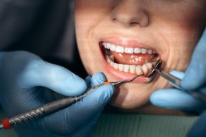 Seeing the Dentist Soon? Here’s How to Get Ready Without Stress