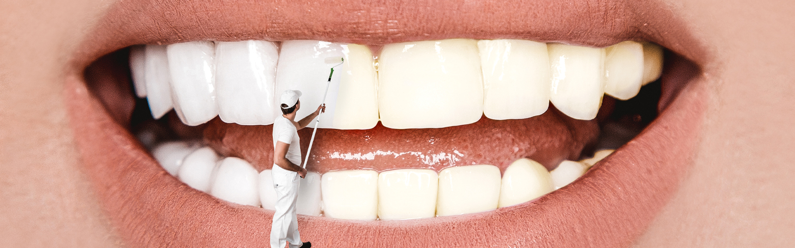 5 Ways Cosmetic Dentistry Can Boost Your Confidence