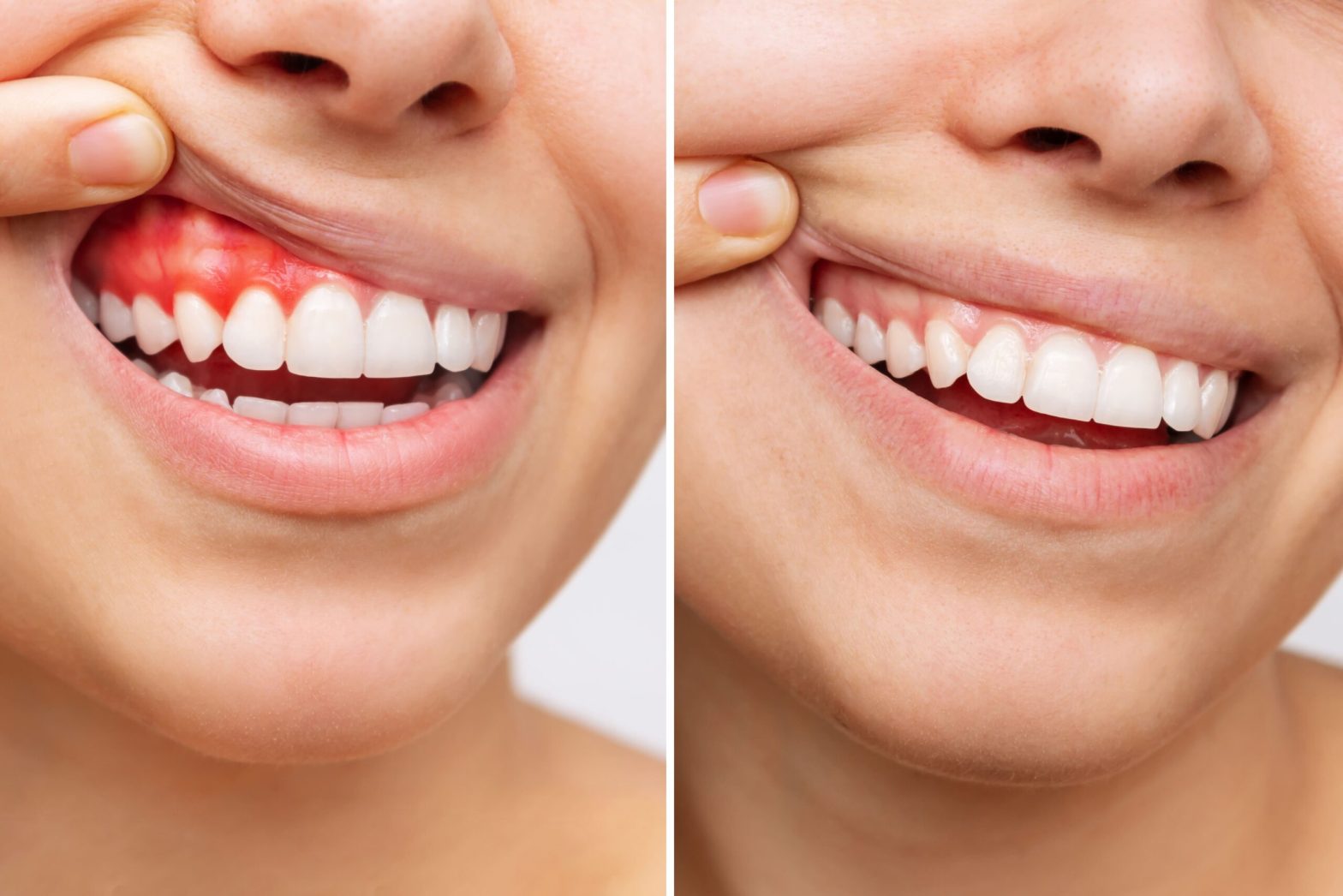 Dental Professionals Reveal the Best Ways to Treat Gum Problems