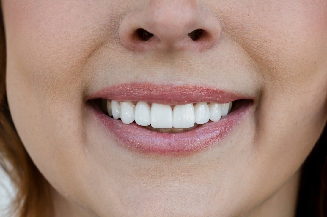 How Dental Bridges Restore Your Smile and Confidence