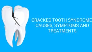 Cracked Tooth Syndrome: Symptoms, Causes, and Treatment Cracked Tooth Syndrome: Symptoms, Causes, and Treatment