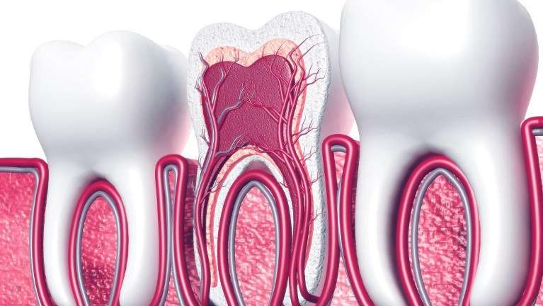 Is Root Canal Painful? Myths vs Facts