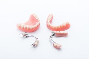 Modern Dentures vs. Traditional Dentures: What’s the Difference?