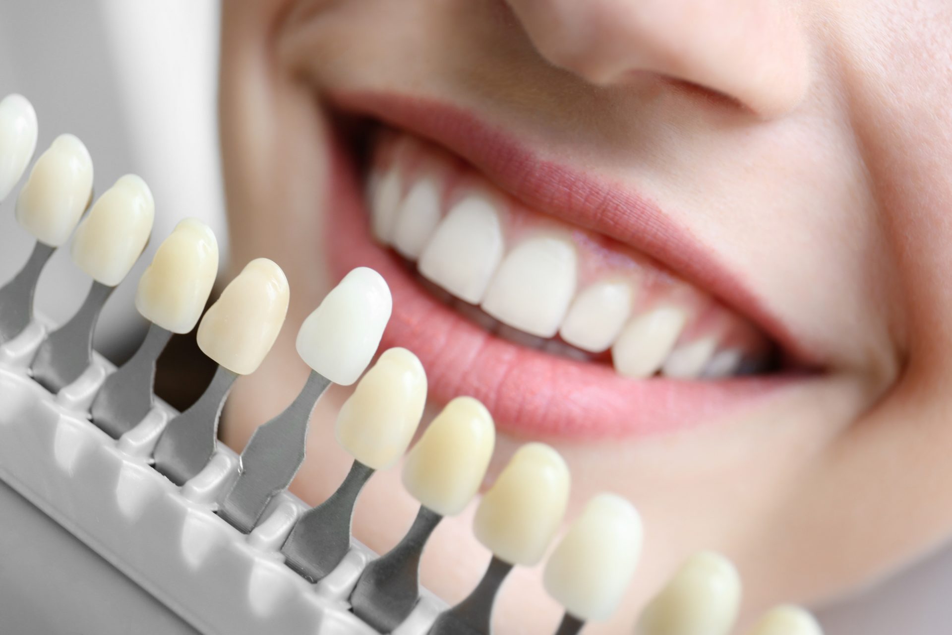 Modern Cosmetic Dental Treatments