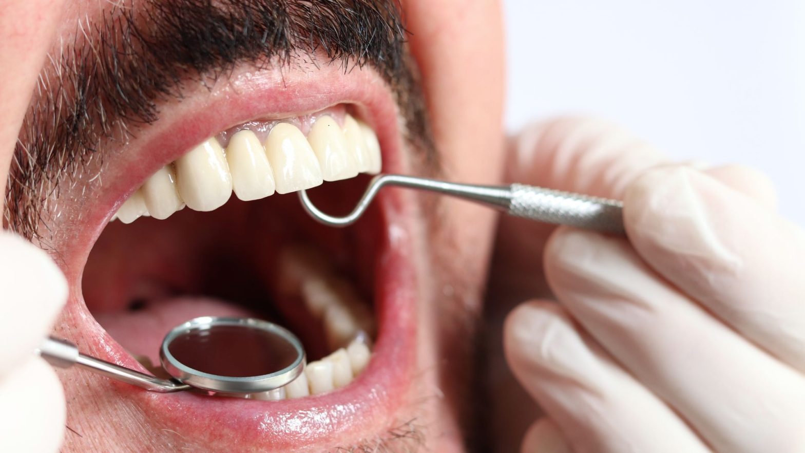 Why Dental Checkups Matter