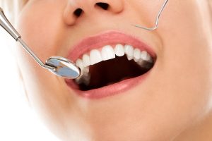 Why Dental Checkups Matter