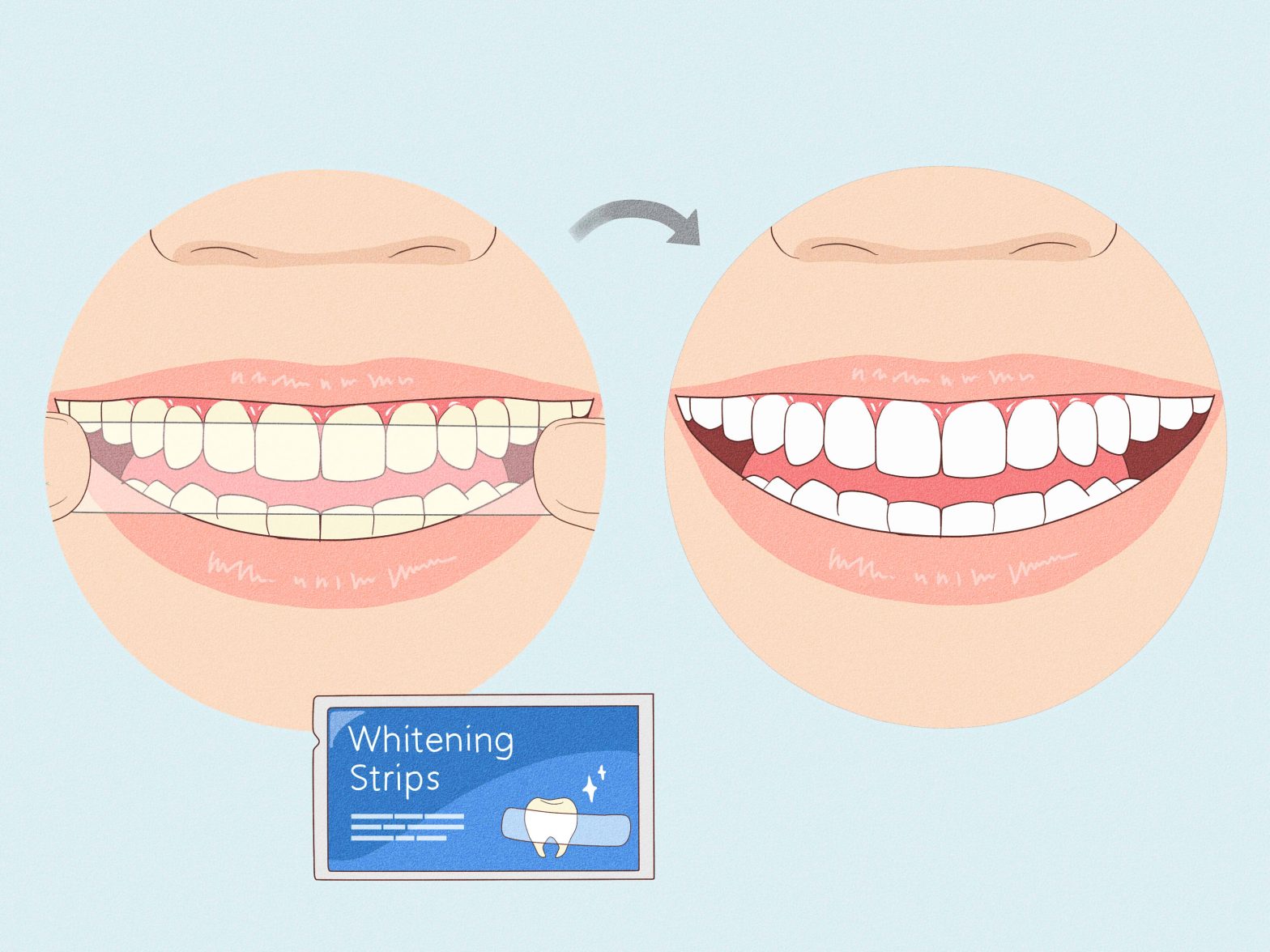 Your Guide to a Better Smile