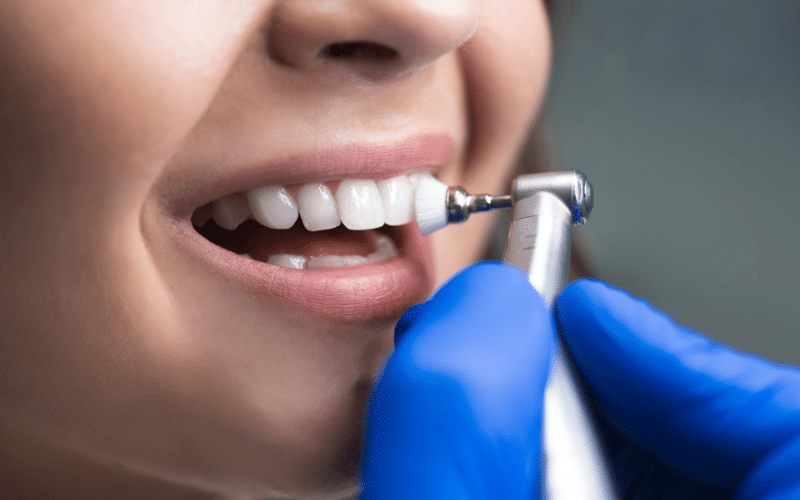 A First-Timer’s Guide to Getting Your Teeth Cleaned at the Dentist