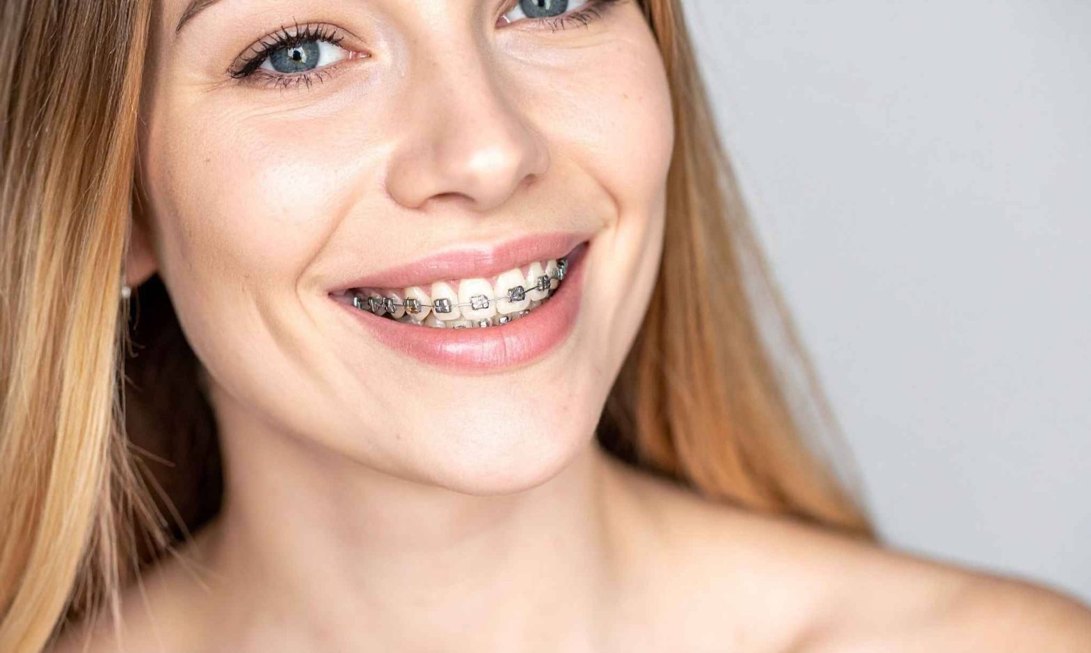 How Long Does Orthodontic Treatment Really Take?