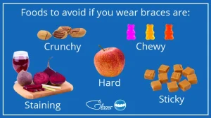 Life with Braces: Foods to Avoid and Care Tips