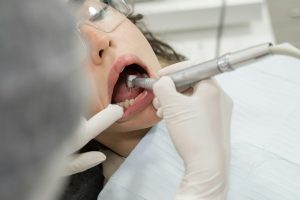 The Truth About Dental Cleanings: What to Expect