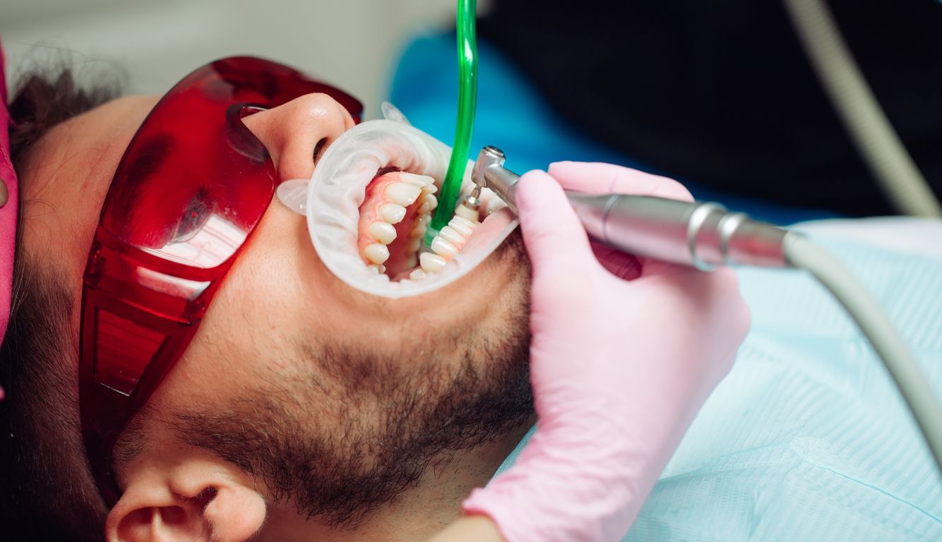 What Really Happens During a Professional Teeth Cleaning?