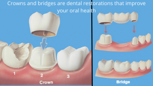 How Dental Crowns Restore Damaged Teeth and Improve Oral Health