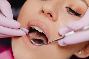 Tooth Caps 101: Everything You Should Know Before Getting One