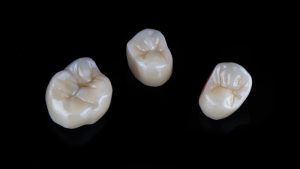 What Are Tooth Caps? A Complete Guide to Dental Crowns