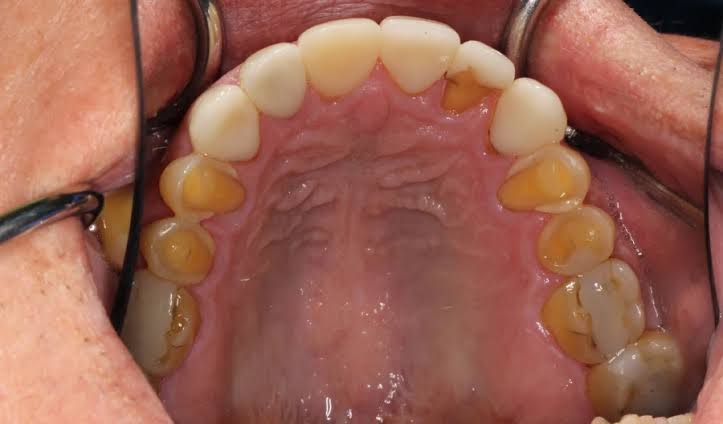 Common Dental Problems and How to Prevent Them
