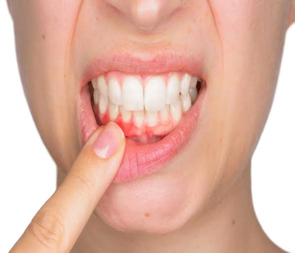 Stress and Oral Health: Can Stress Worsen Gum Disease?