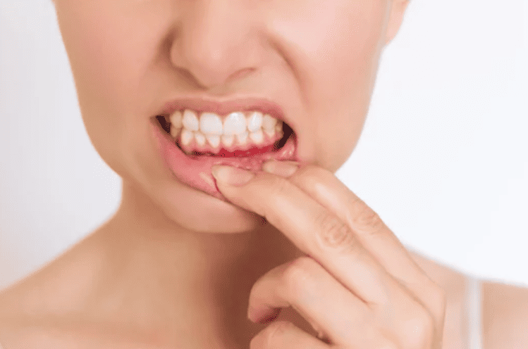 The Biggest Dental Myths You Should Stop Believing