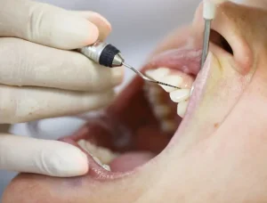 What to Expect During Gum Disease Treatment at the Dentist What to Expect During Gum Disease Treatment at the Dentist