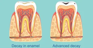Common Dental Problems and How to Avoid Them Common Dental Problems and How to Avoid Them