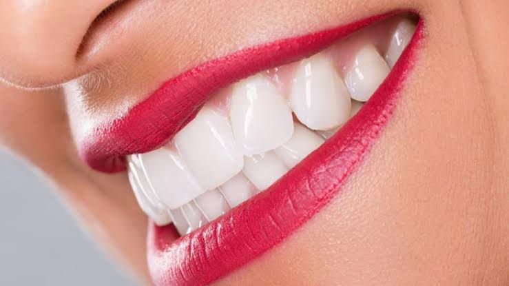 How to Choose the Right Type of Veneers