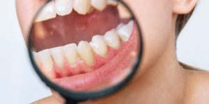 A Daily Routine for Keeping Plaque Under Control