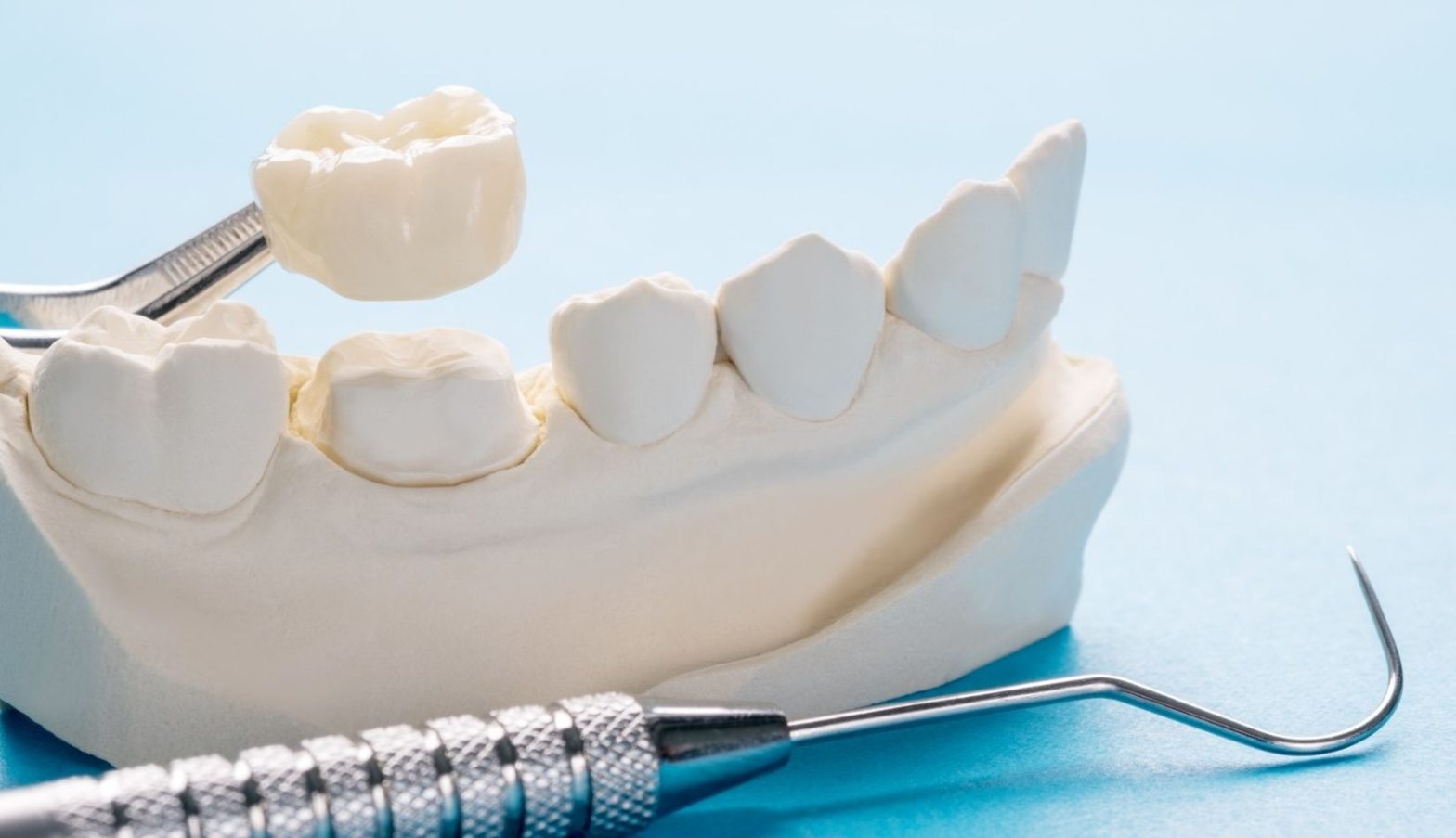 Tooth Caps Explained: Types, Benefits, and Costs