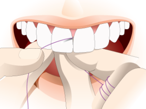 Why Brushing and Flossing Aren't Enough to Keep Your Teeth Clean